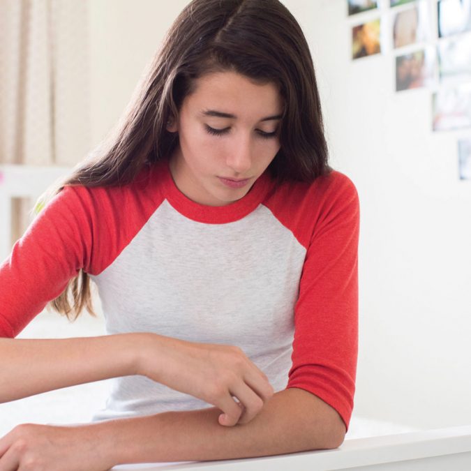 Teenage Girl Scratching Her Arm