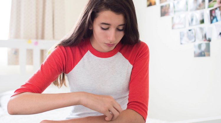 Teenage Girl Scratching Her Arm